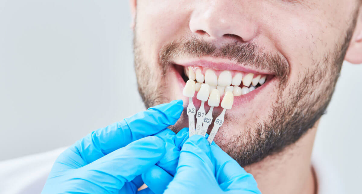 dental veneers pros and cons