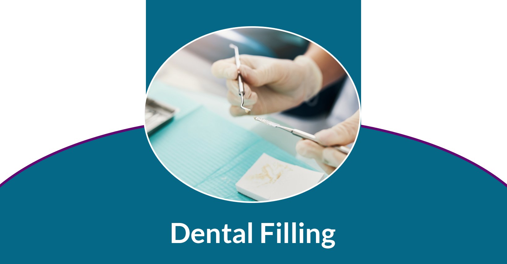 White Fillings Near Me Glendale Dentist Take Delta Dental