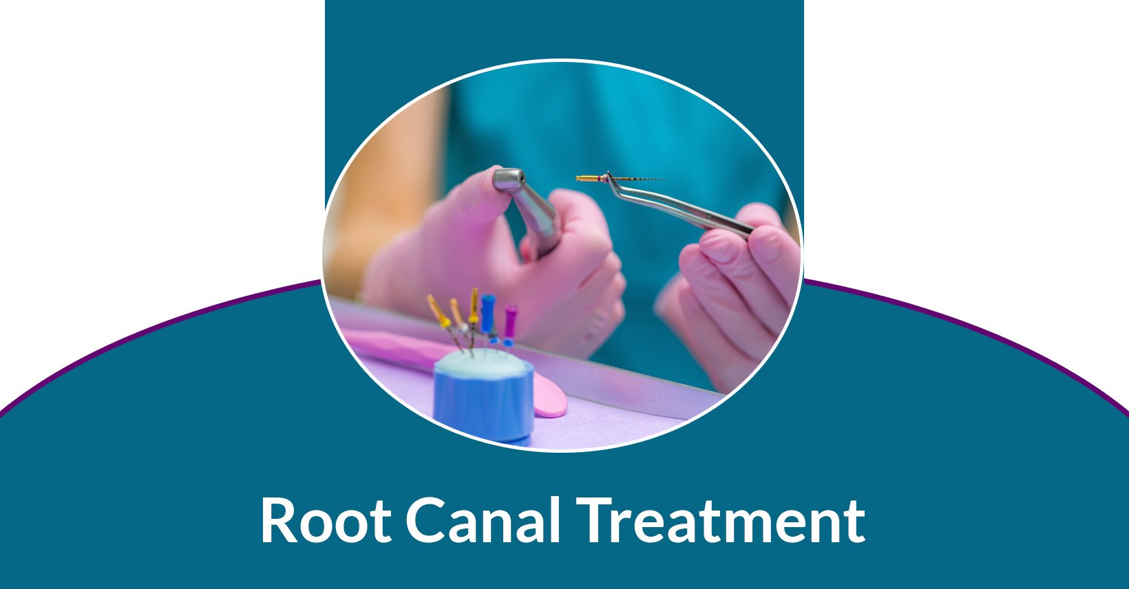 Root Canals in Glendale Emergency Endodontics Treatment