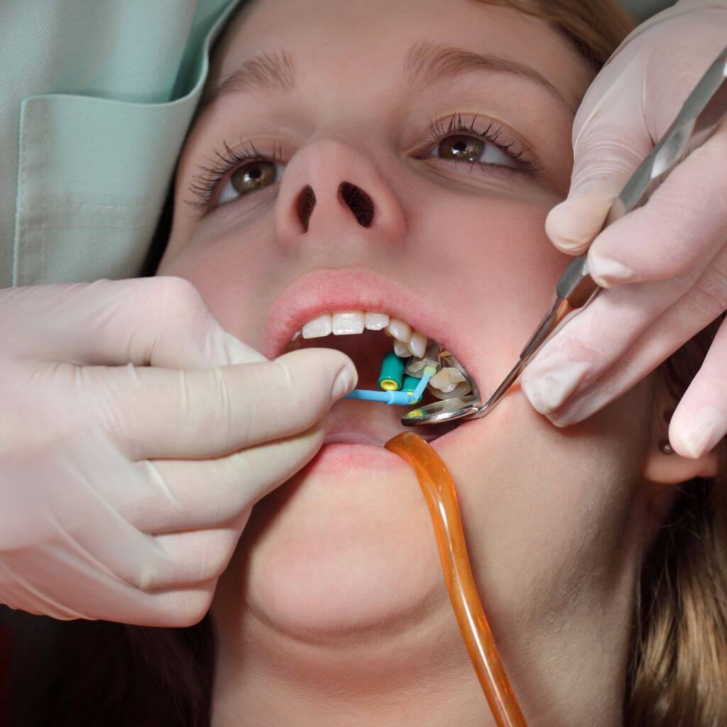 Dentist operating patient
