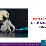Do’s And Don’ts After Wisdom Teeth Removal