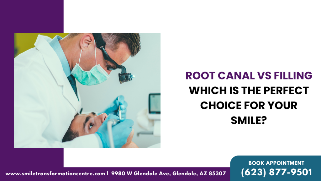 Root Canal Vs Filling Which is The Perfect Choice For Your Smile