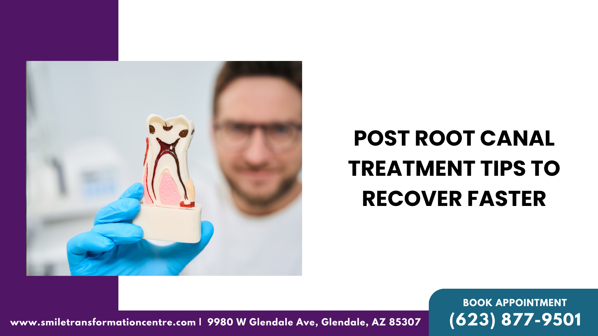 Post Root Canal Treatments Tips To Recover Faster