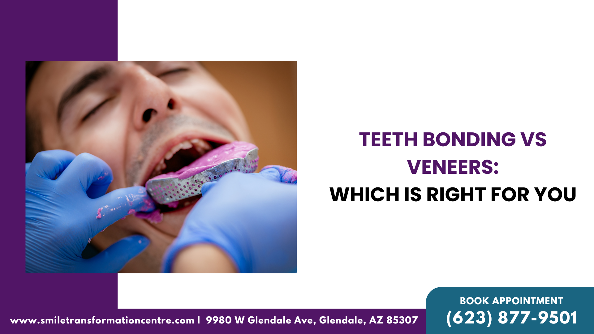 Teeth Bonding Vs Veneers Which Is Right For You