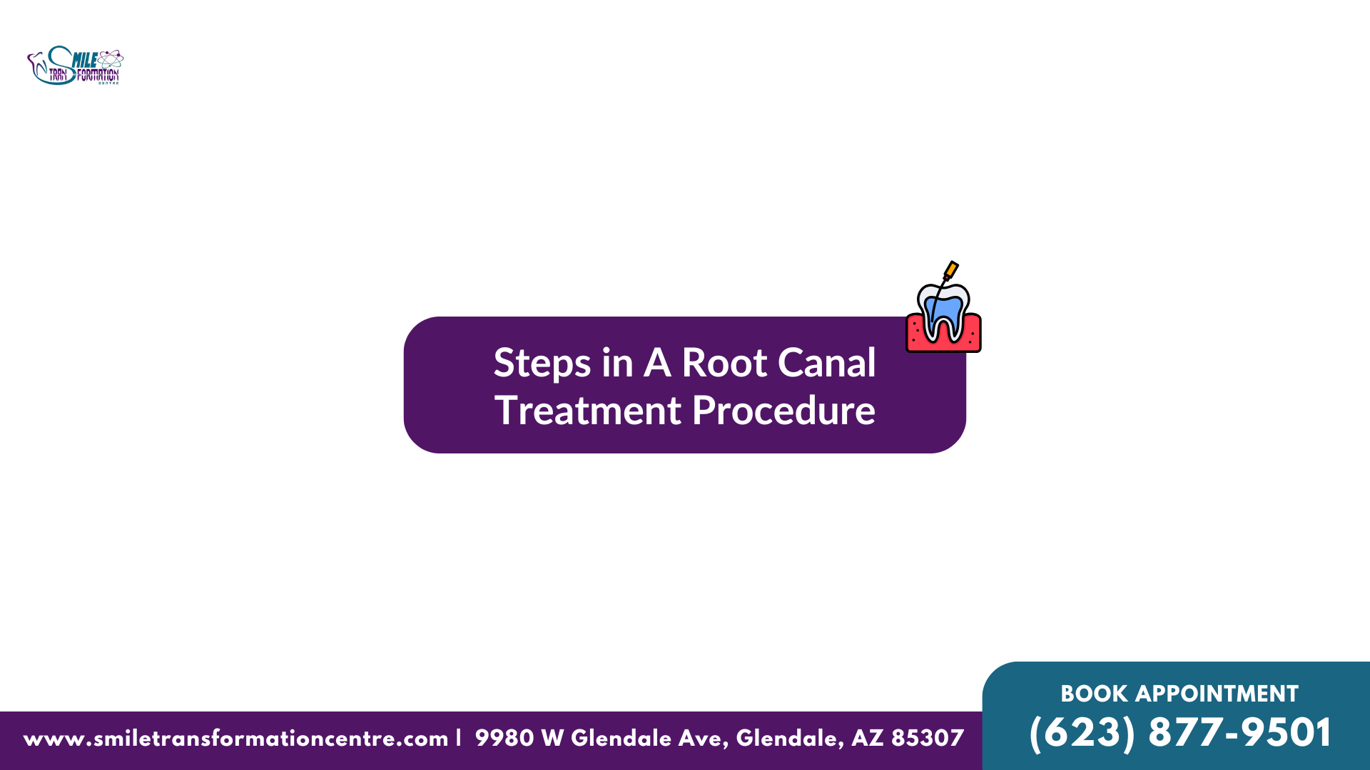 Steps In Root Canal Treatment Procedure