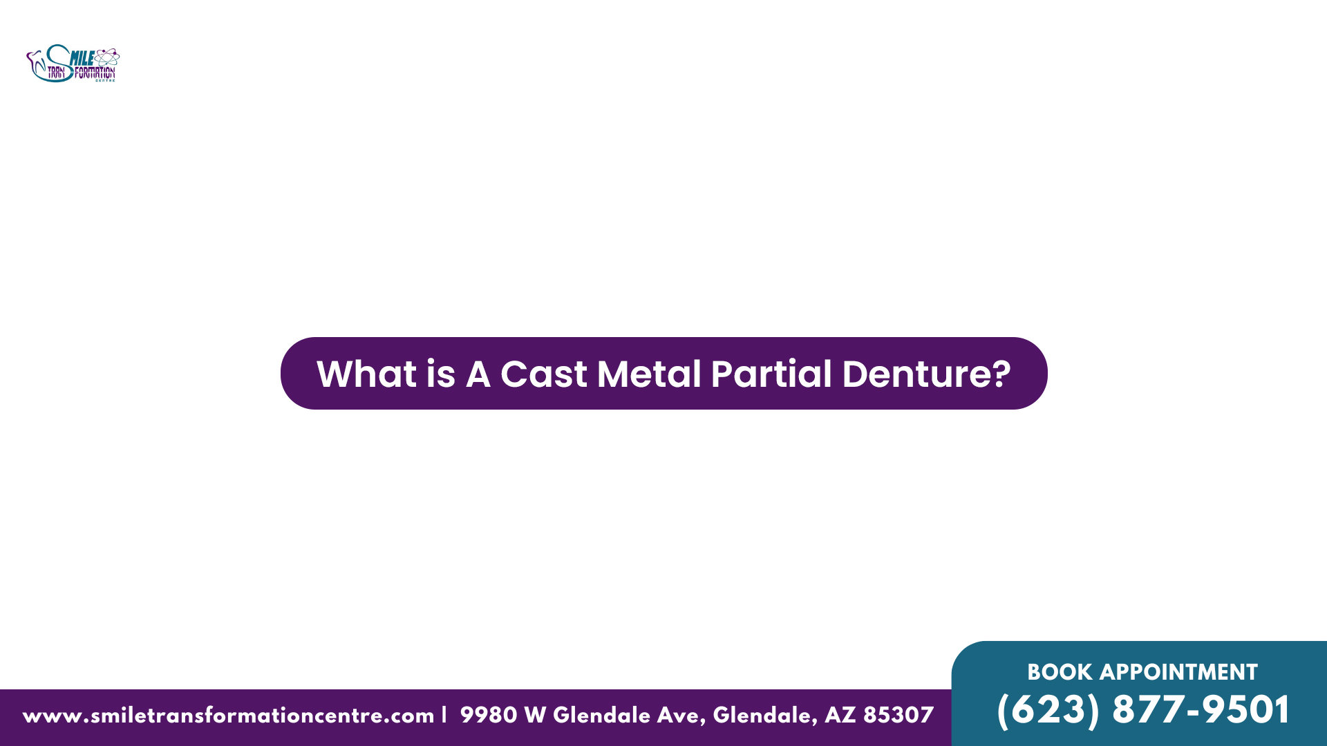 Cantilever Dental Bridges - 1