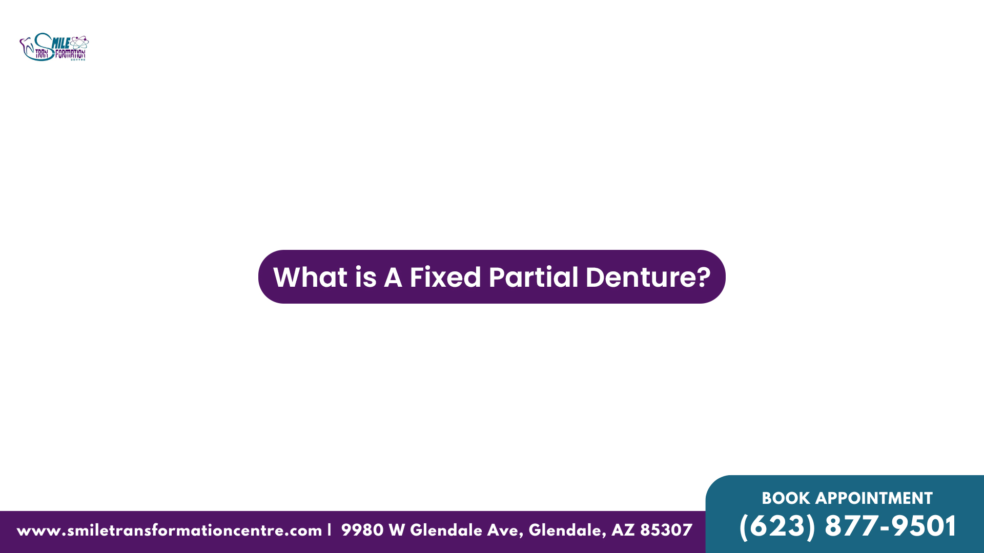 What is A Fixed Partial Dentures