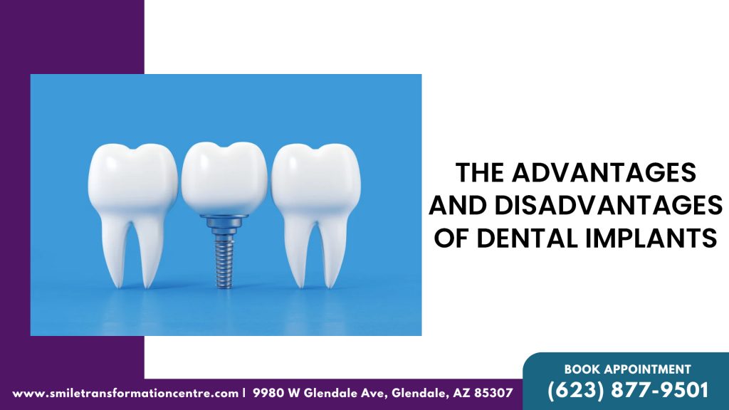 The Advantages and Disadvantages Of Dental Implants