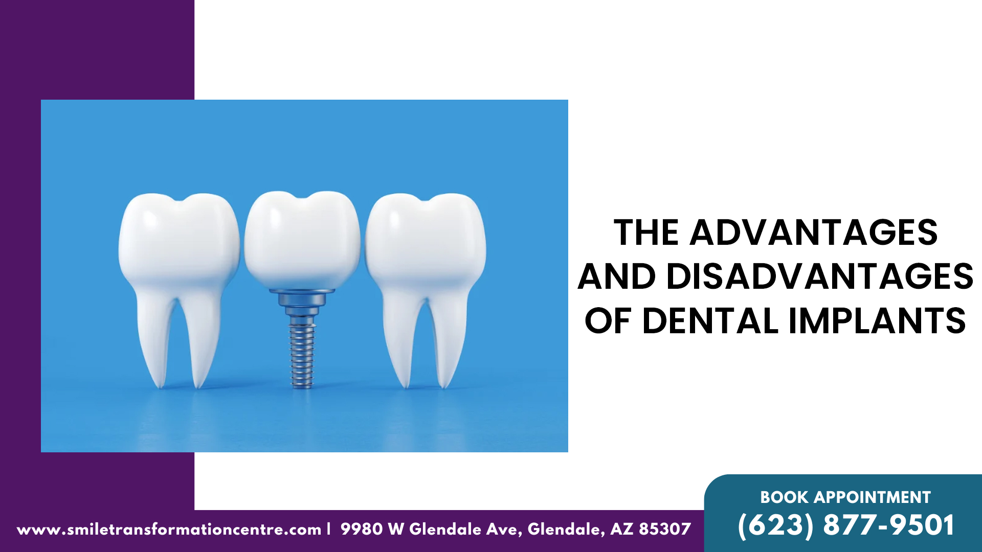 The Advantages and Disadvantages Of Dental Implants
