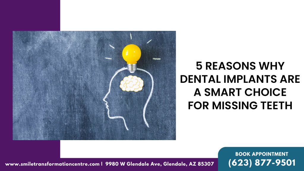 5 Reasons Why Dental Implants Are A Smart Choice For Missing Teeth