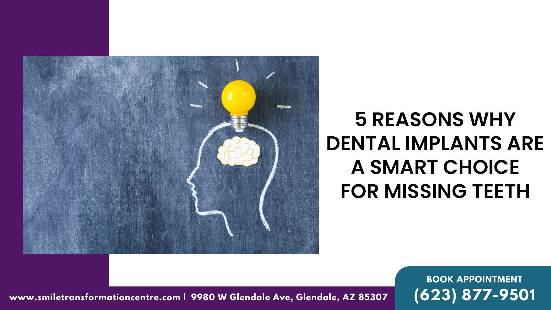 5 Reasons Why Dental Implants Are A Smart Choice For Missing Teeth