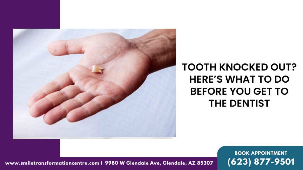 Tooth-Knocked-Out